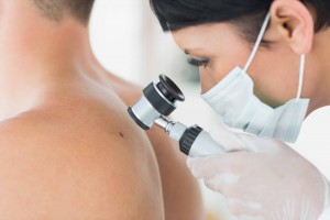 Moles and Screenings… What You Need to Know